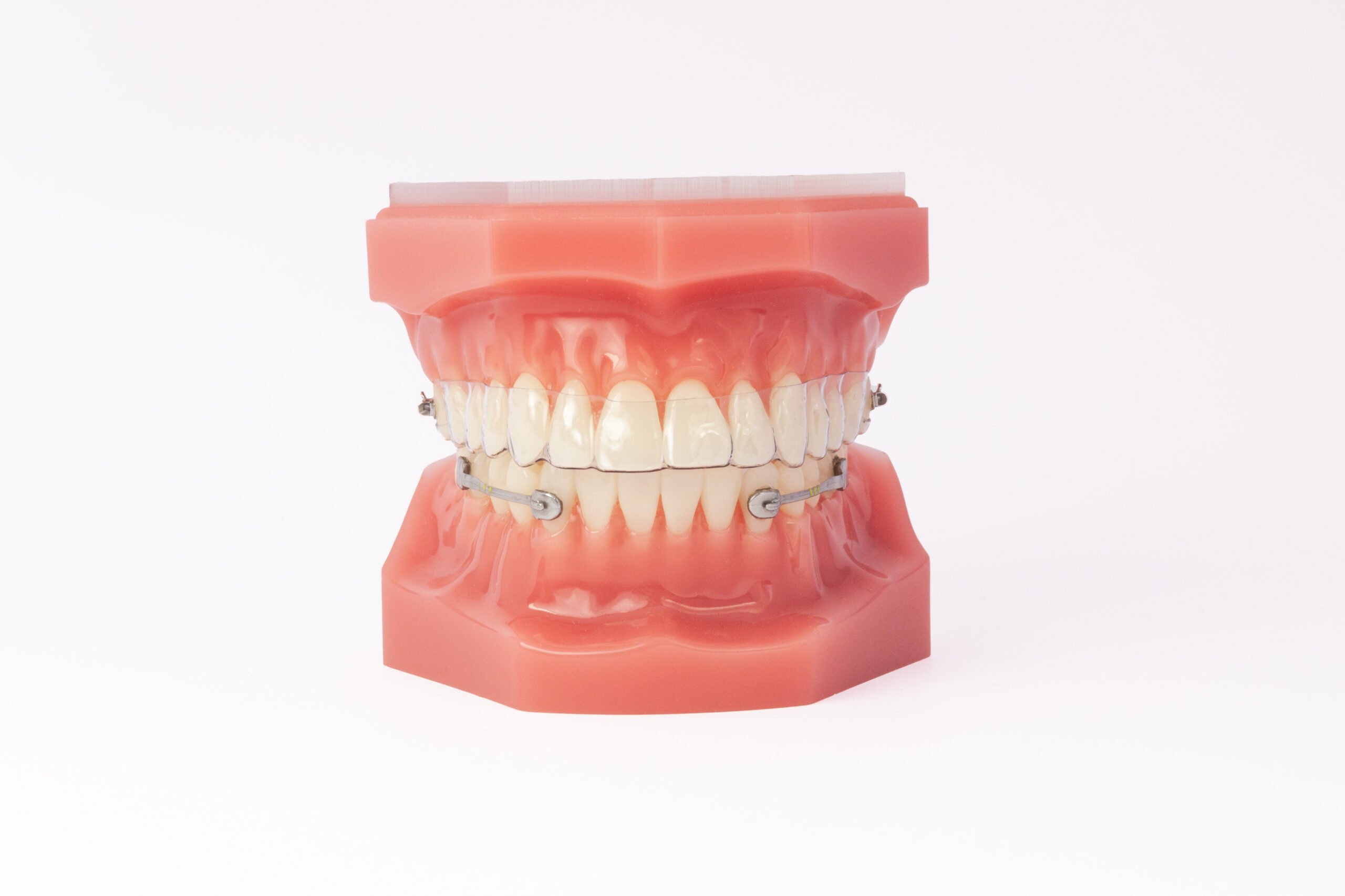Henry_Shein_Carriere_Motion_3D_with_clear_aligner Henry_Shein_Carriere_Motion_3D_with_clear_aligner